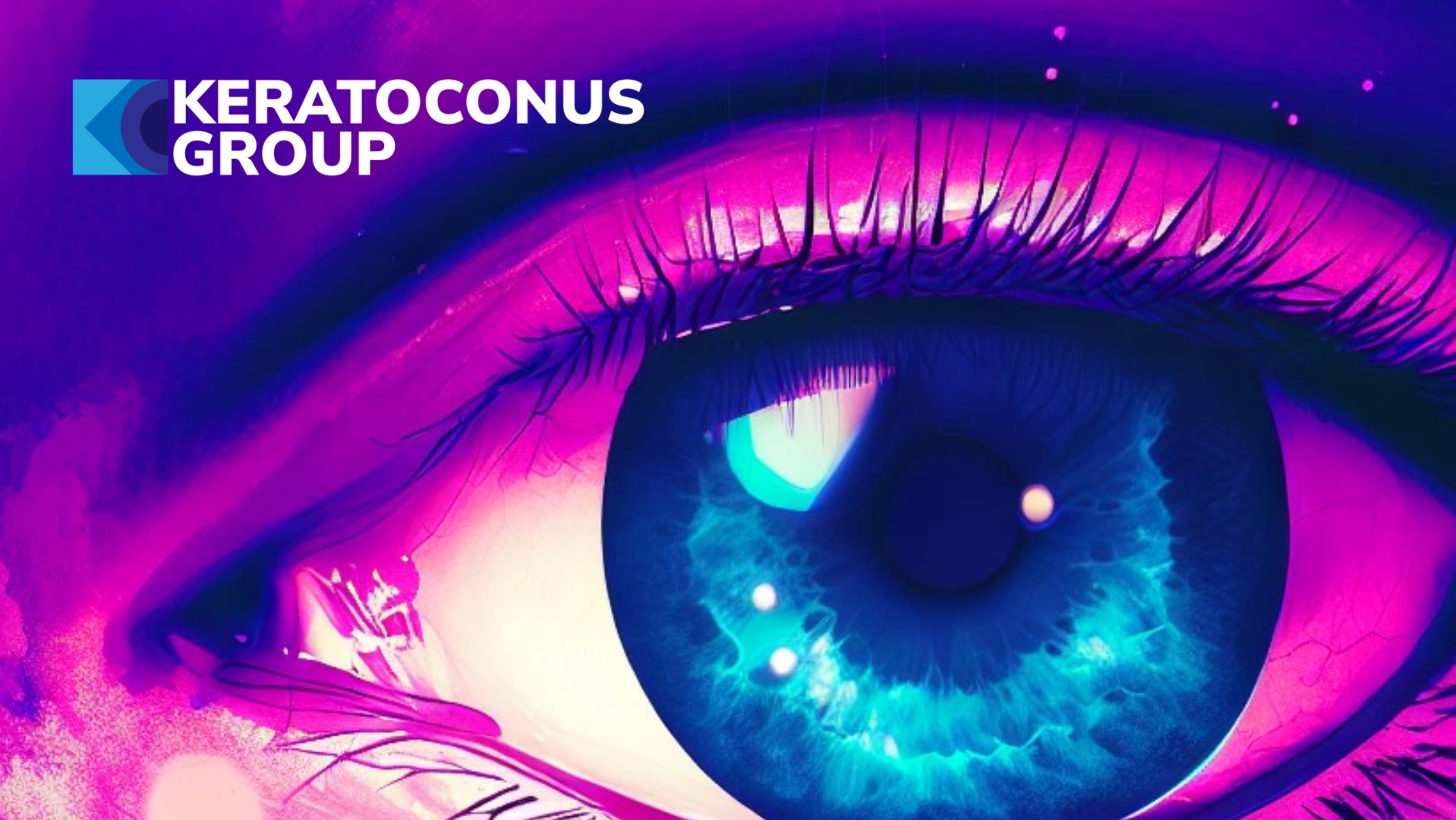 Keratoconus Group: A Place to Learn and Share about Keratoconus